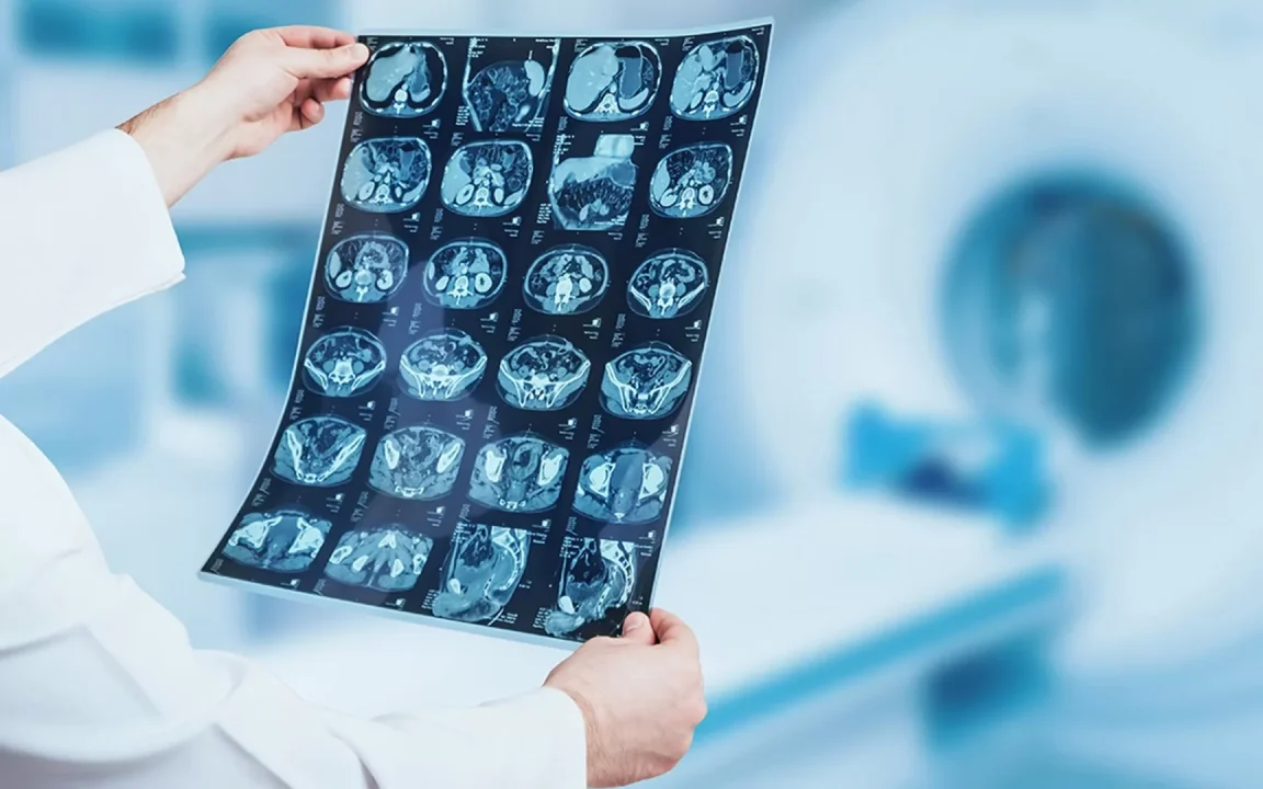 découvrez comment le docteur ia devient une alliée fiable pour améliorer votre santé grâce à l'intelligence artificielle et aux avancées technologiques.